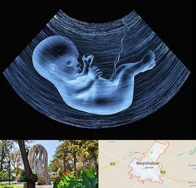 دکتر متخصص غربال گری در نیشابور