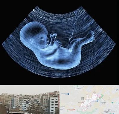 دکتر متخصص غربال گری در محمد شهر کرج