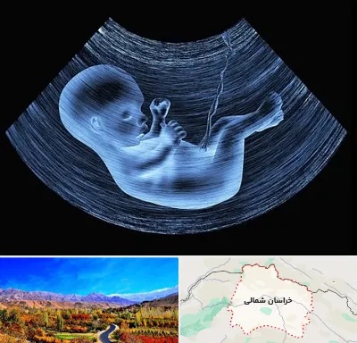 دکتر متخصص غربال گری در خراسان شمالی