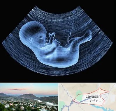 دکتر متخصص غربال گری در لواسان