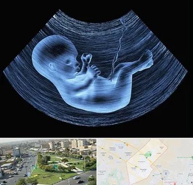 دکتر متخصص غربال گری در کمال شهر کرج