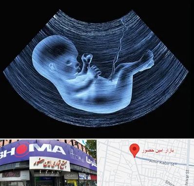 دکتر متخصص غربال گری در امین حضور