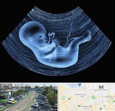 دکتر متخصص غربال گری در جنوب تهران 