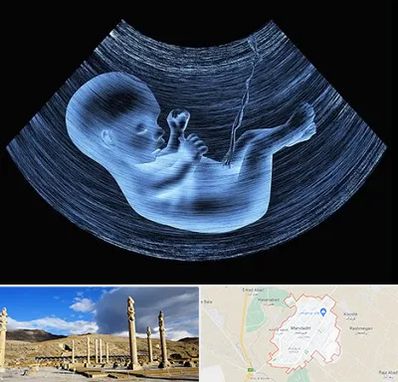 دکتر متخصص غربال گری در مرودشت