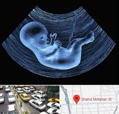 دکتر متخصص غربال گری در مطهری تهران