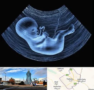 دکتر متخصص غربال گری در تایباد