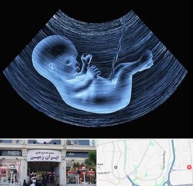 دکتر متخصص غربال گری در ایران زمین