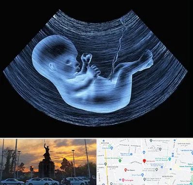 دکتر متخصص غربال گری در میدان حر