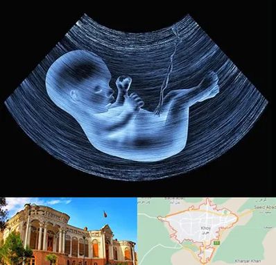 دکتر متخصص غربال گری در خوی