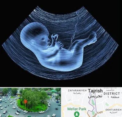 دکتر متخصص غربال گری در تجریش 