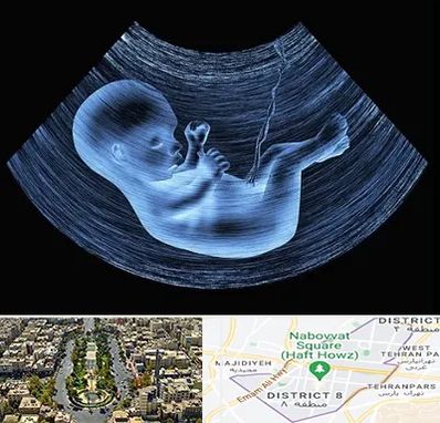 دکتر متخصص غربال گری در نارمک 