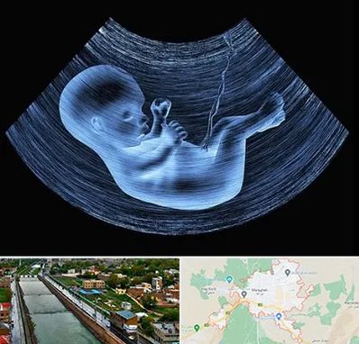 دکتر متخصص غربال گری در مراغه