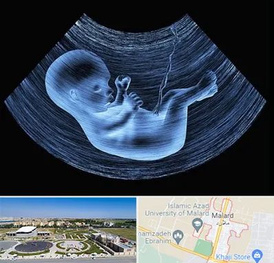 دکتر متخصص غربال گری در ملارد