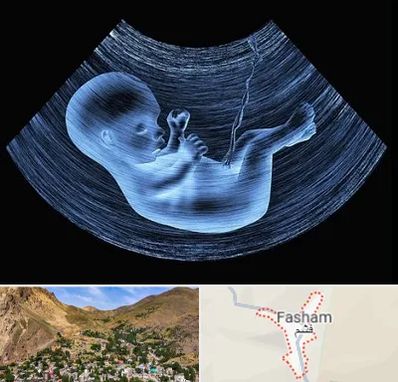 دکتر متخصص غربال گری در فشم