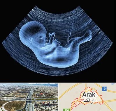 دکتر متخصص غربال گری در اراک