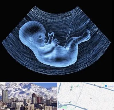 دکتر متخصص غربال گری در ازگل