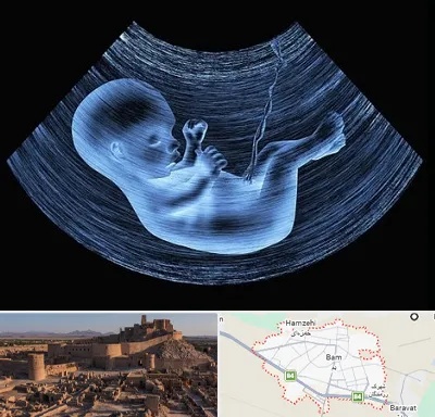دکتر متخصص غربال گری در بم