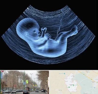 دکتر متخصص غربال گری در نظرآباد کرج