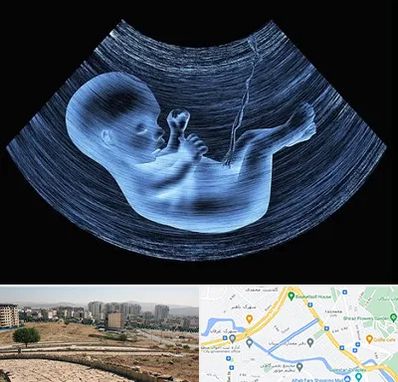 دکتر متخصص غربال گری در کوی وحدت شیراز