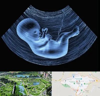 دکتر متخصص غربال گری در بجنورد