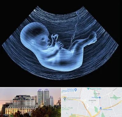 دکتر متخصص غربال گری در فرشته 