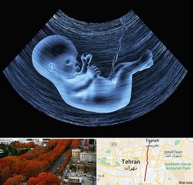 دکتر متخصص غربال گری در ولیعصر 