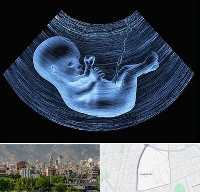 دکتر متخصص غربال گری در جمشیدیه