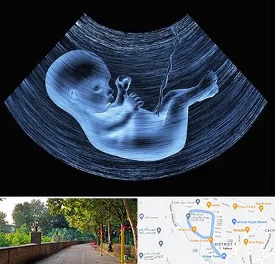 دکتر متخصص غربال گری در بلوار گیلان رشت