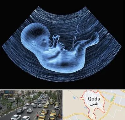 دکتر متخصص غربال گری در شهر قدس