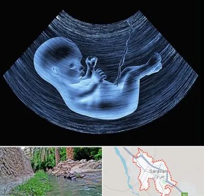 دکتر متخصص غربال گری در سراوان