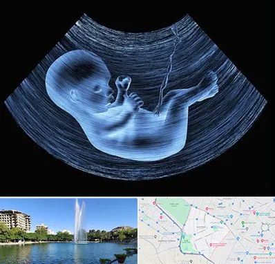 دکتر متخصص غربال گری در کوهسنگی مشهد