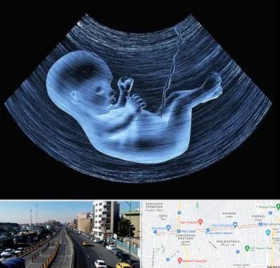 دکتر متخصص غربال گری در پیروزی 