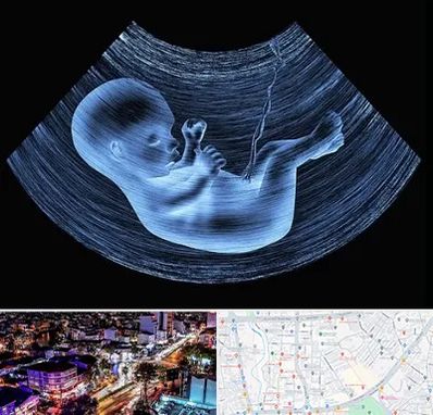 دکتر متخصص غربال گری در منظریه رشت