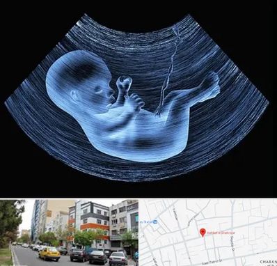 دکتر متخصص غربال گری در هفده شهریور تبریز