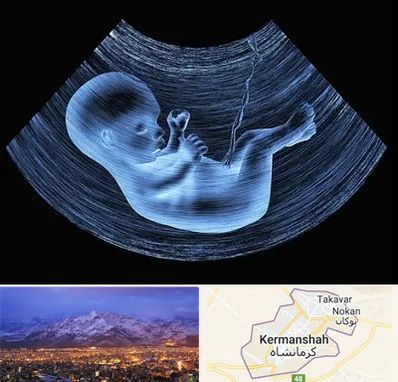 دکتر متخصص غربال گری در کرمانشاه