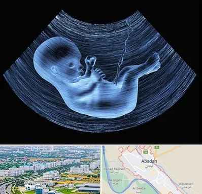 دکتر متخصص غربال گری در آبادان