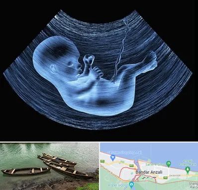 دکتر متخصص غربال گری در بندر انزلی