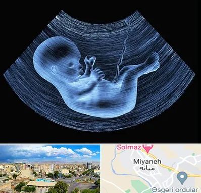 دکتر متخصص غربال گری در میانه