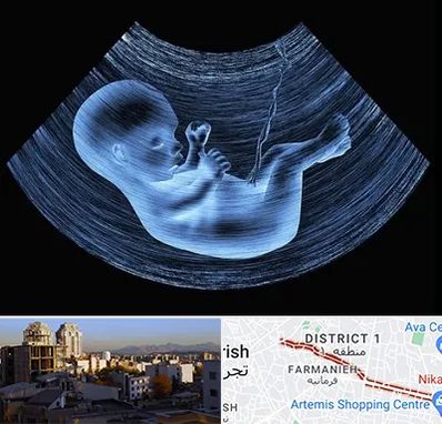 دکتر متخصص غربال گری در فرمانیه 