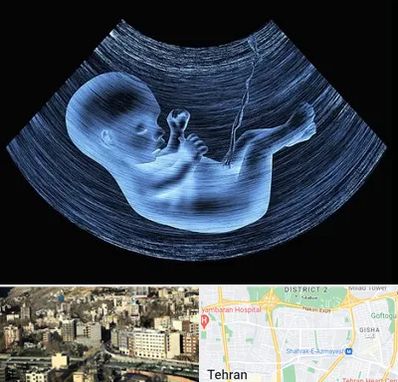 دکتر متخصص غربال گری در مرزداران 