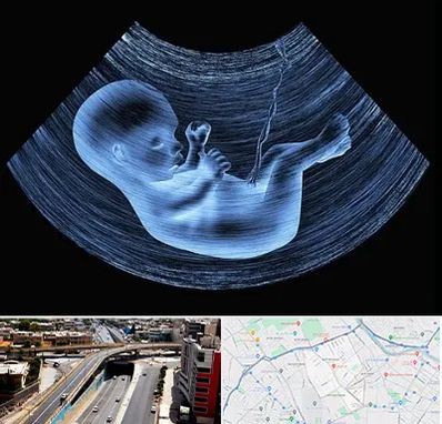 دکتر متخصص غربال گری در ستارخان شیراز