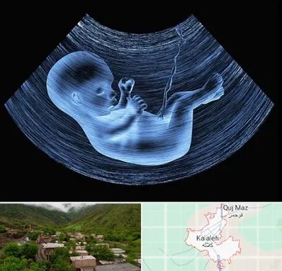 دکتر متخصص غربال گری در کلاله