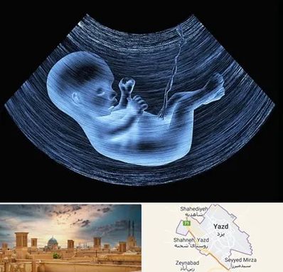 دکتر متخصص غربال گری در یزد