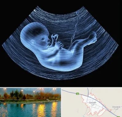 دکتر متخصص غربال گری در قروه