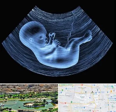 دکتر متخصص غربال گری در منطقه 9 تهران