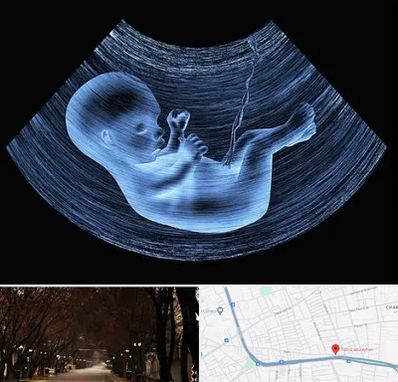 دکتر متخصص غربال گری در ابوریحان تبریز