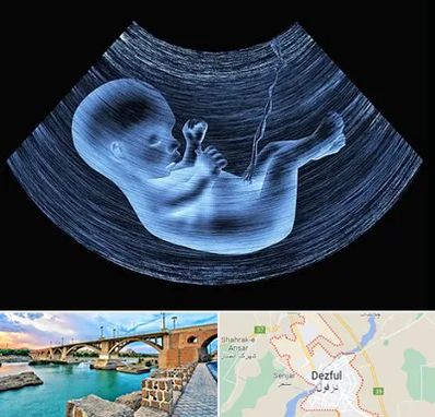 دکتر متخصص غربال گری در دزفول