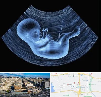 دکتر متخصص غربال گری در شهرک راه آهن