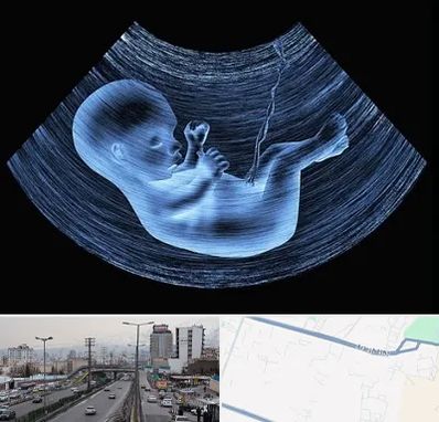 دکتر متخصص غربال گری در بلوار ارتش