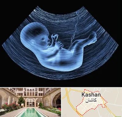 دکتر متخصص غربال گری در کاشان